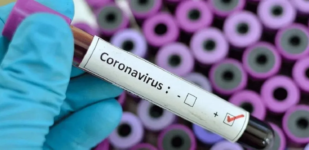 COVID en Roca: Ante la presencia de síntomas acudir al médico y evitar reuniones. 