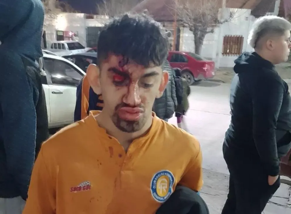 Violencia: endurecen las sanciones a quienes provoquen disturbios en espectáculos públicos
