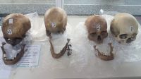 Macabro: encontraron cuatro cráneos humanos en la valija de una pasajera