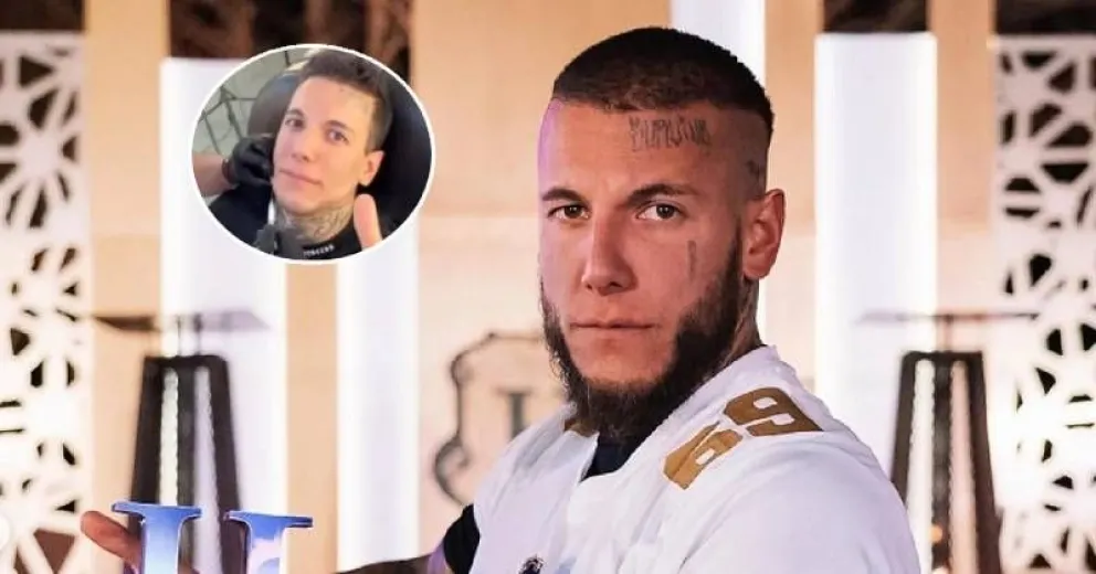 Alex Caniggia contó qué sienten las mujeres al ver su nueva mandíbula