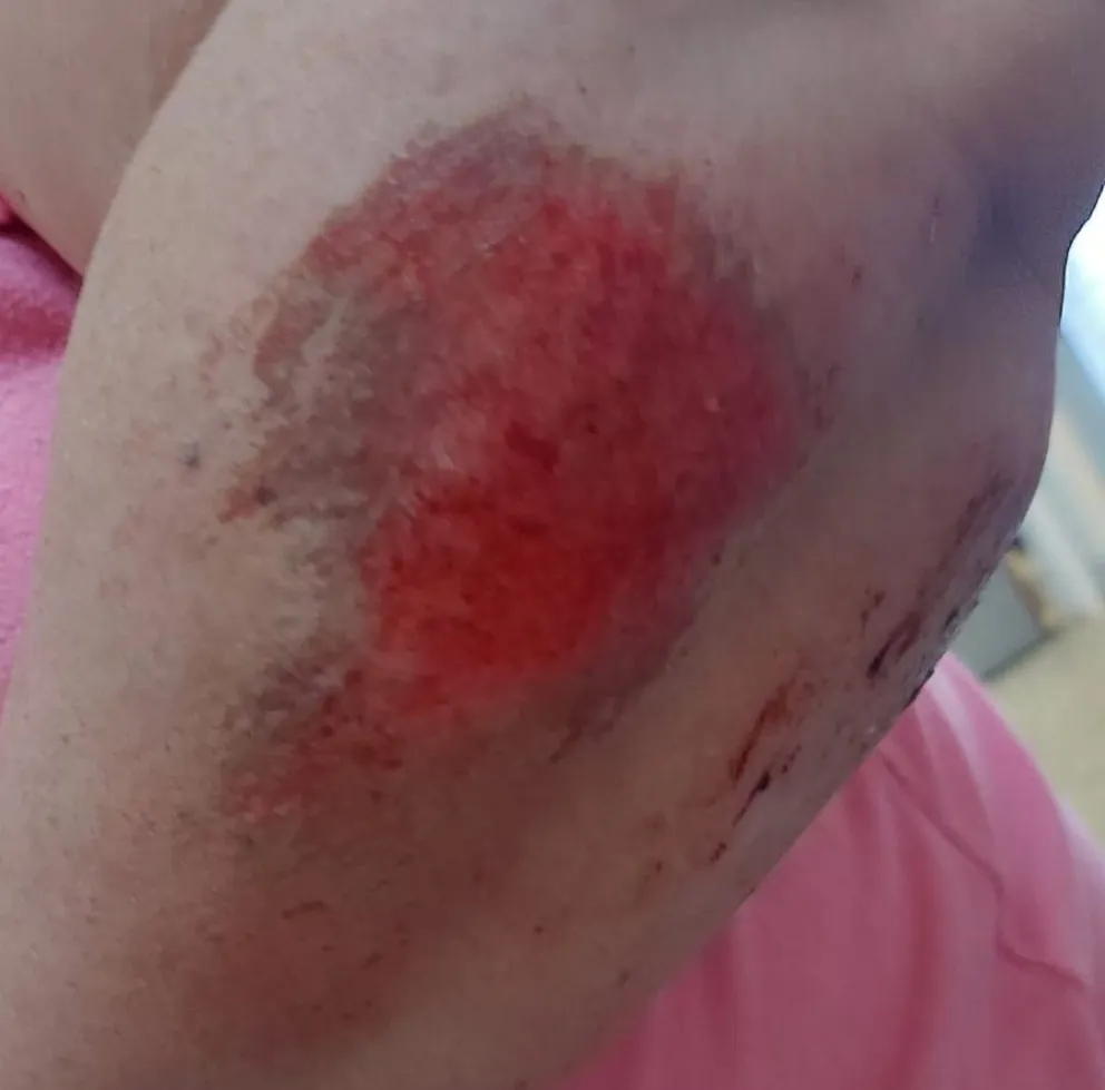 Una mujer y su hija cayeron de su moto tras ser atacadas por perros: vecinos reclaman soluciones