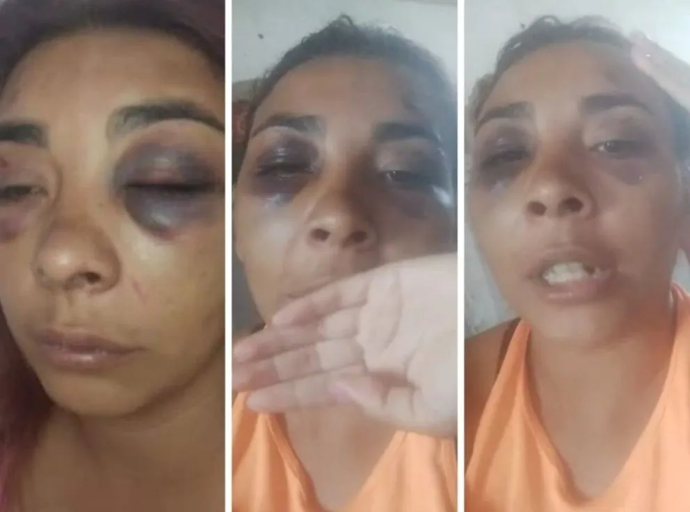 Feroz golpiza a una mujer delante de sus hijos menores: denuncian que fue la pareja de un concejal