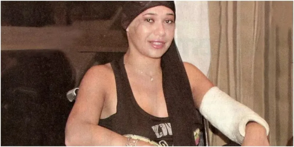 Así está hoy Mariana de Melo, la vedette de Sofovich que volvió de la muerte