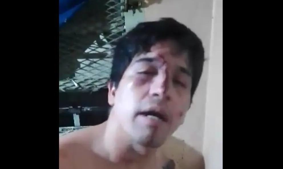 VIDEO: Habló un interno del Penal 2º y explicó la situación de fuga 