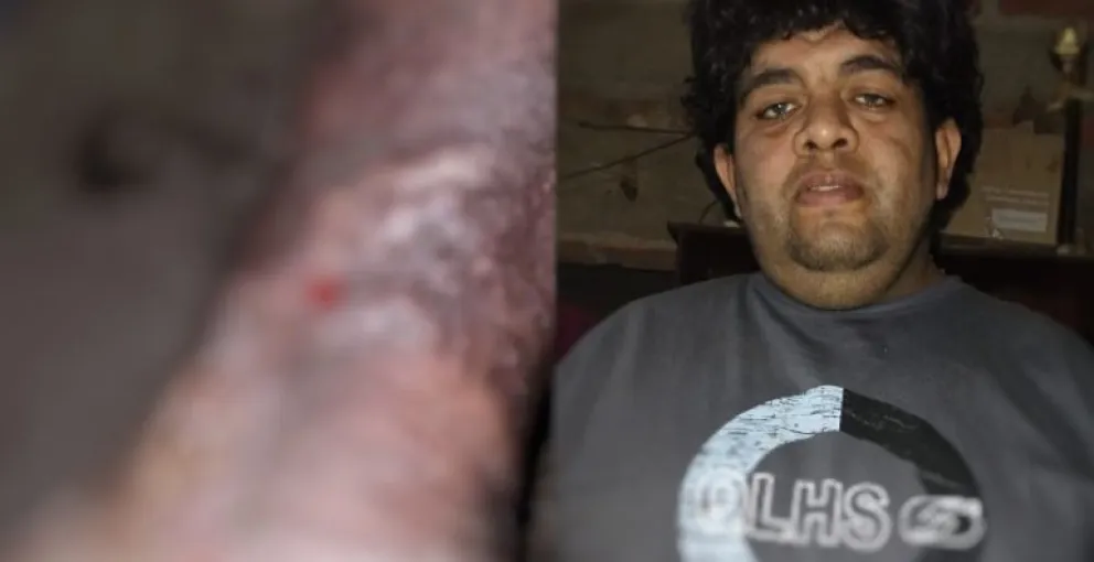 Tiene una enfermedad peligrosa que no le permite trabajar y se encuentra desesperado 